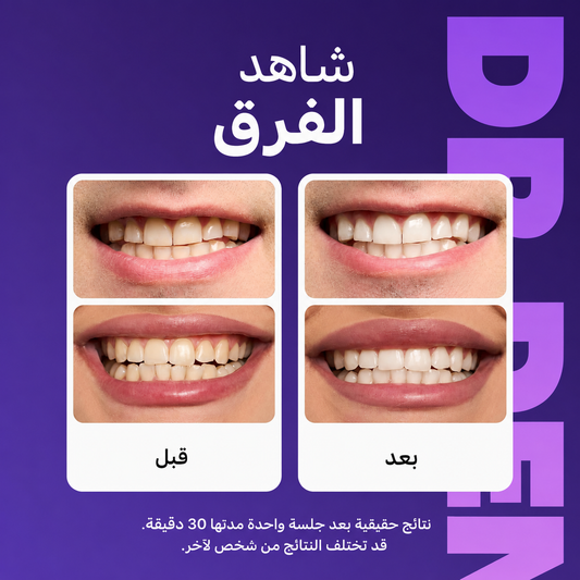 شرائط تبييض الأسنان